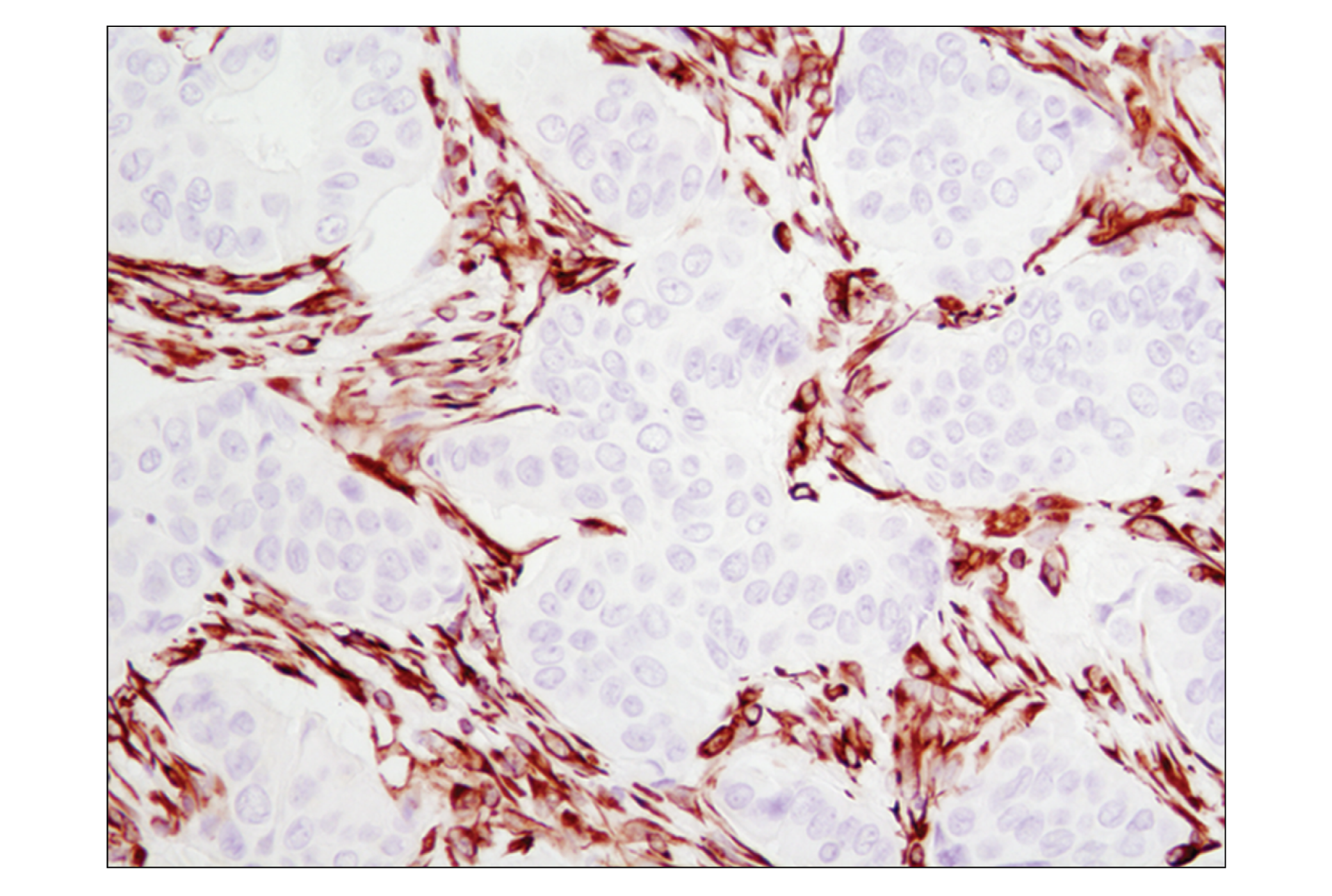  Image 23: Cell Fractionation Antibody Sampler Kit