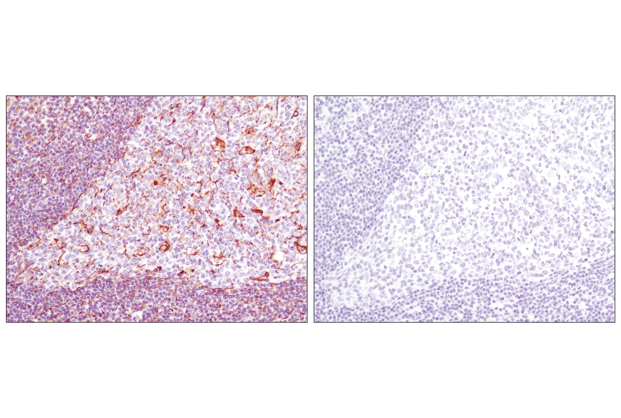  Image 33: Cell Fractionation Antibody Sampler Kit
