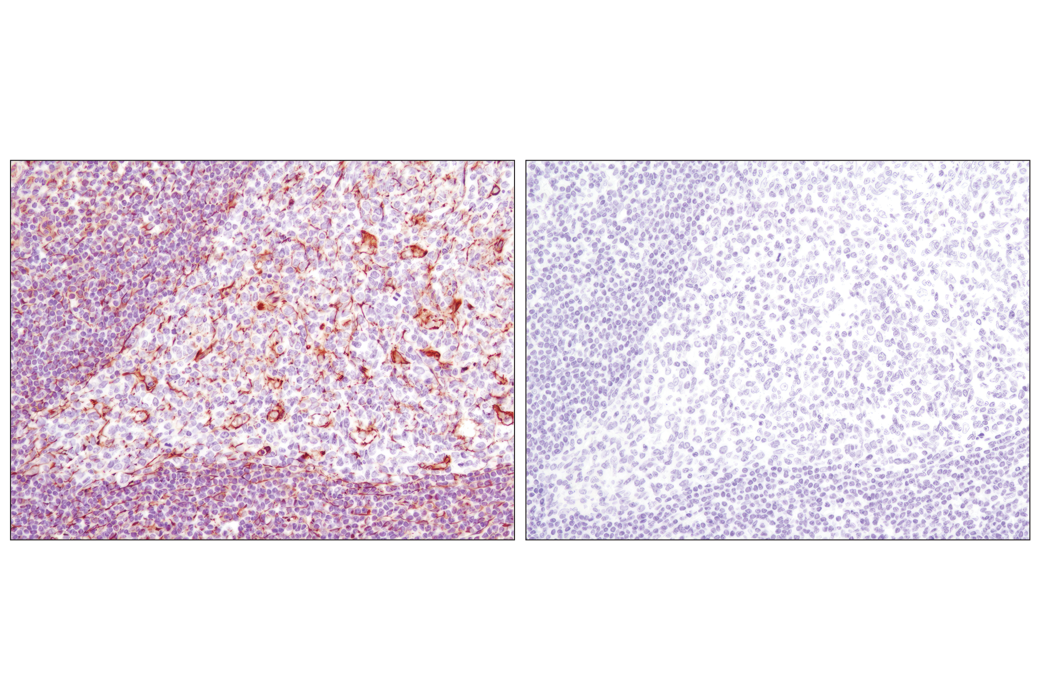 Immunohistochemistry Image 8: Vimentin (D21H3) XP® Rabbit mAb