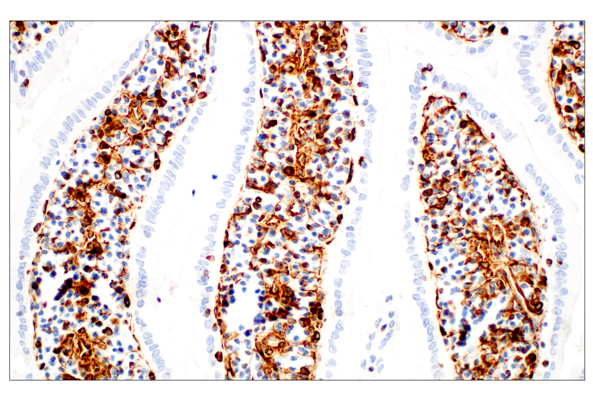  Image 32: Cell Fractionation Antibody Sampler Kit