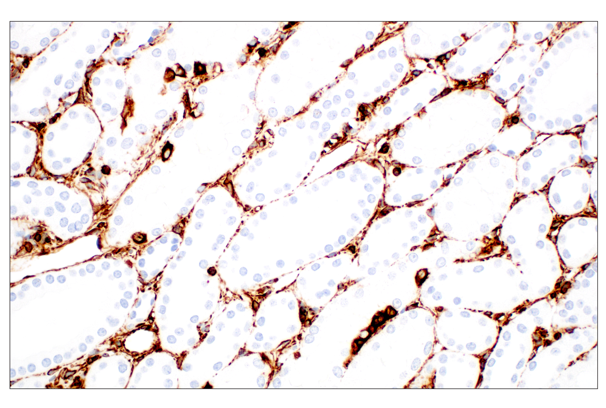  Image 30: Cell Fractionation Antibody Sampler Kit