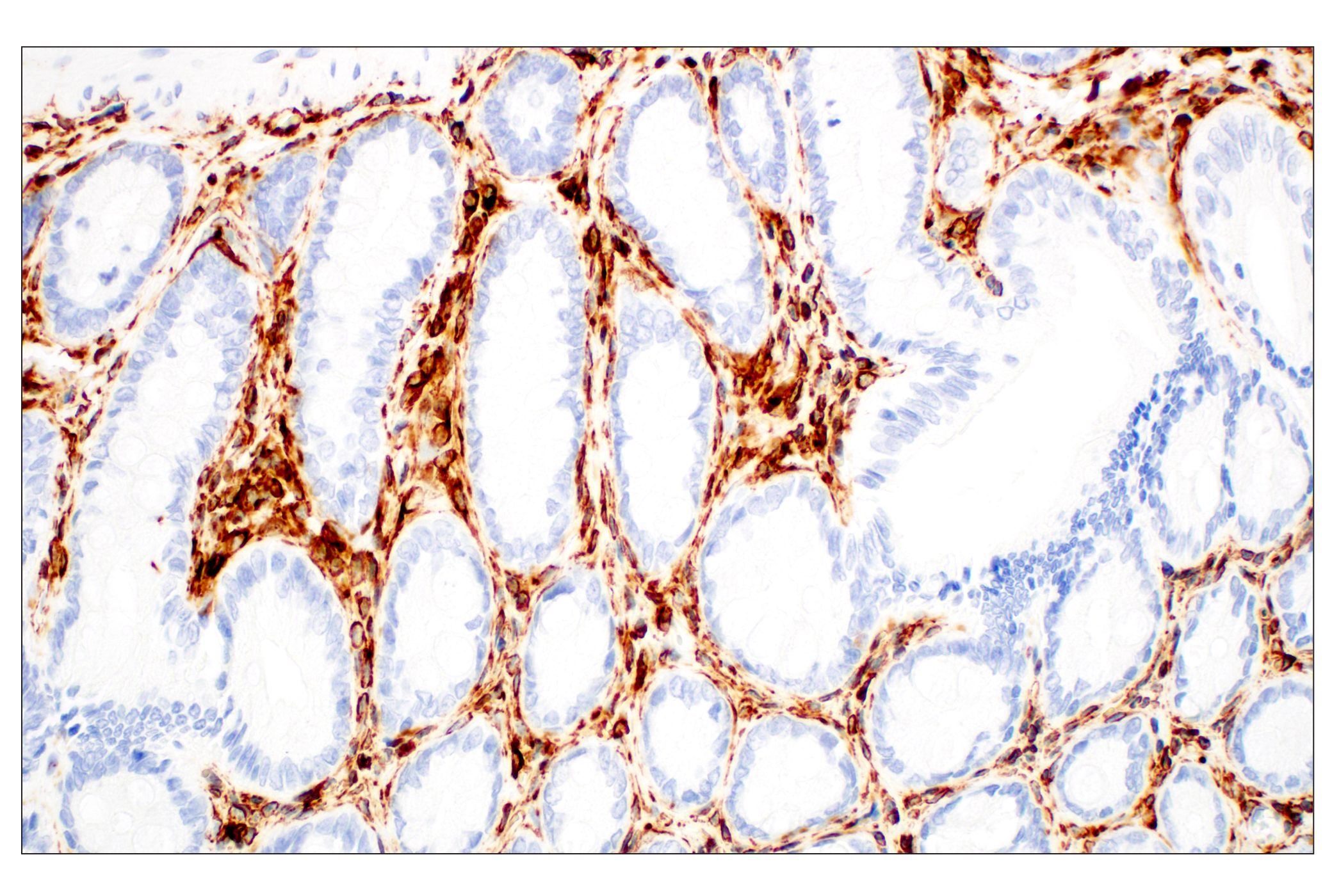 Image 27: Cell Fractionation Antibody Sampler Kit