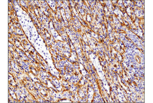 Immunohistochemistry Image 4: IFITM3 (D8E8G) XP® Rabbit mAb