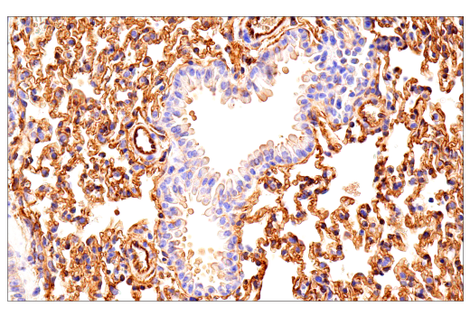 Immunohistochemistry Image 2: Crry (E9F1S) Rabbit mAb