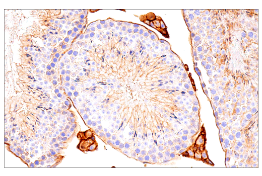 Immunohistochemistry Image 3: Crry (E9F1S) Rabbit mAb