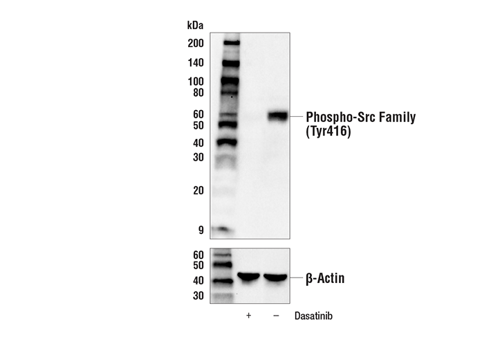 Western Blotting Image 1: Phospho-Src Family (Tyr416) (E6G4R) Rabbit mAb