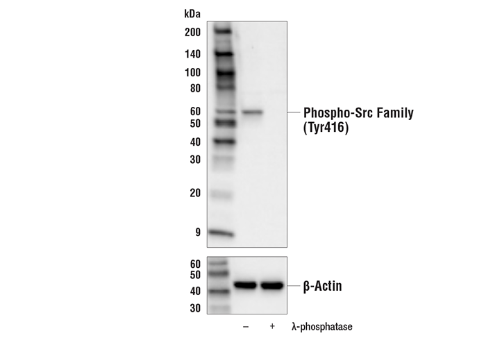 Western Blotting Image 2: Phospho-Src Family (Tyr416) (E6G4R) Rabbit mAb