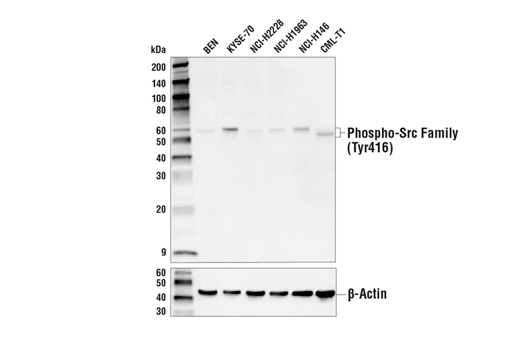 Western Blotting Image 3: Phospho-Src Family (Tyr416) (E6G4R) Rabbit mAb