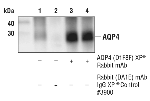  Image 17: Astrocyte Markers Antibody Sampler Kit