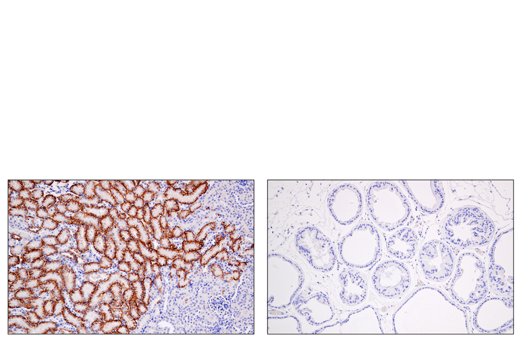  Image 39: Astrocyte Markers Antibody Sampler Kit