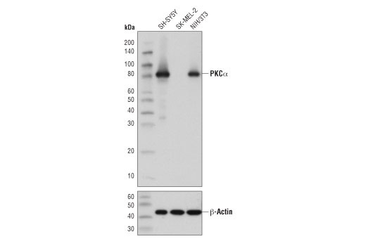 Western Blotting Image 1: PKCα (D7E6E) Rabbit mAb