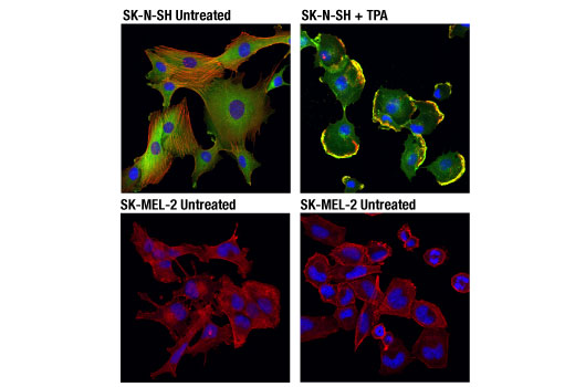 Immunofluorescence Image 1: PKCα (D7E6E) Rabbit mAb