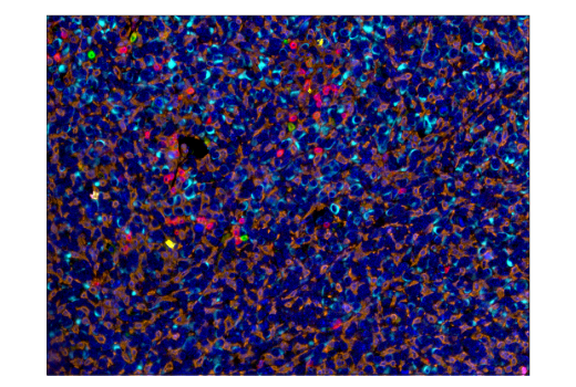 Immunohistochemistry Image 4: CD8α (D4W2Z) XP® Rabbit mAb (BSA and Azide Free)