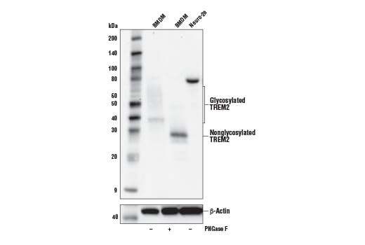  Image 13: Late-Onset Alzheimer's Disease Risk Gene (Mouse Model) Antibody Sampler Kit