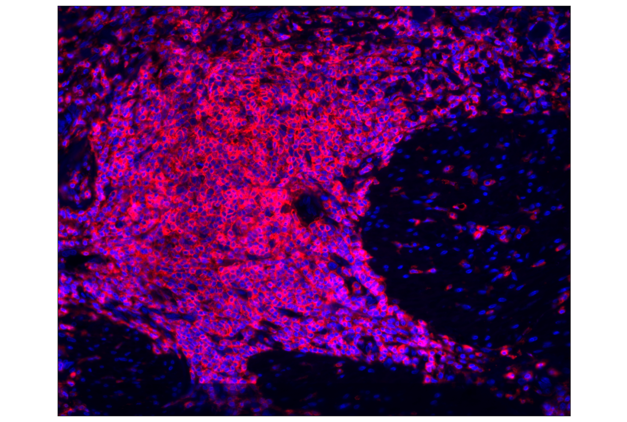 Immunohistochemistry Image 1: CD45 (Intracellular Domain) (D9M8I) XP® Rabbit mAb (Alexa Fluor® 555 Conjugate)