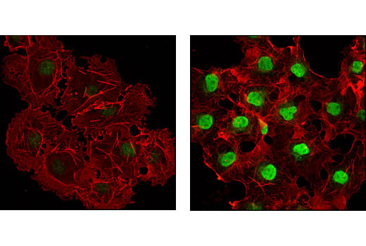 Immunofluorescence Image 1: Phospho-p38 MAPK (Thr180/Tyr182) (D3F9) XP® Rabbit mAb (BSA and Azide Free)