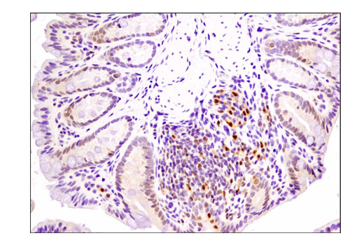 Immunohistochemistry Image 3: Phospho-p38 MAPK (Thr180/Tyr182) (D3F9) XP® Rabbit mAb (BSA and Azide Free)