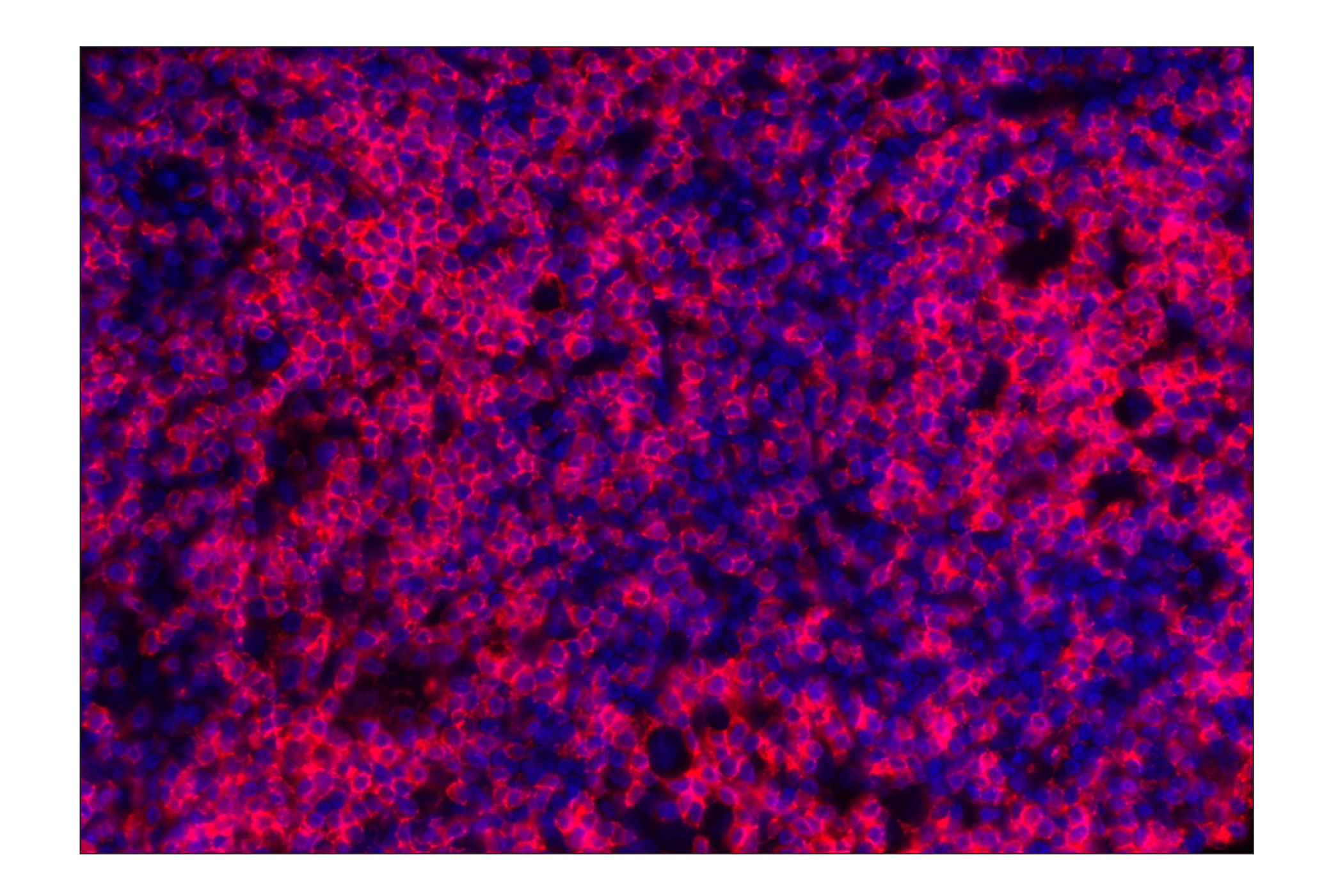 Immunohistochemistry Image 1: CD3ε (D7A6E™) XP® Rabbit mAb (Alexa Fluor® 647 Conjugate)