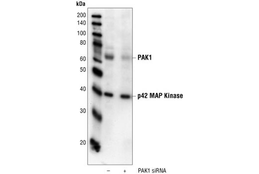  Image 2: SignalSilence® PAK1 siRNA I