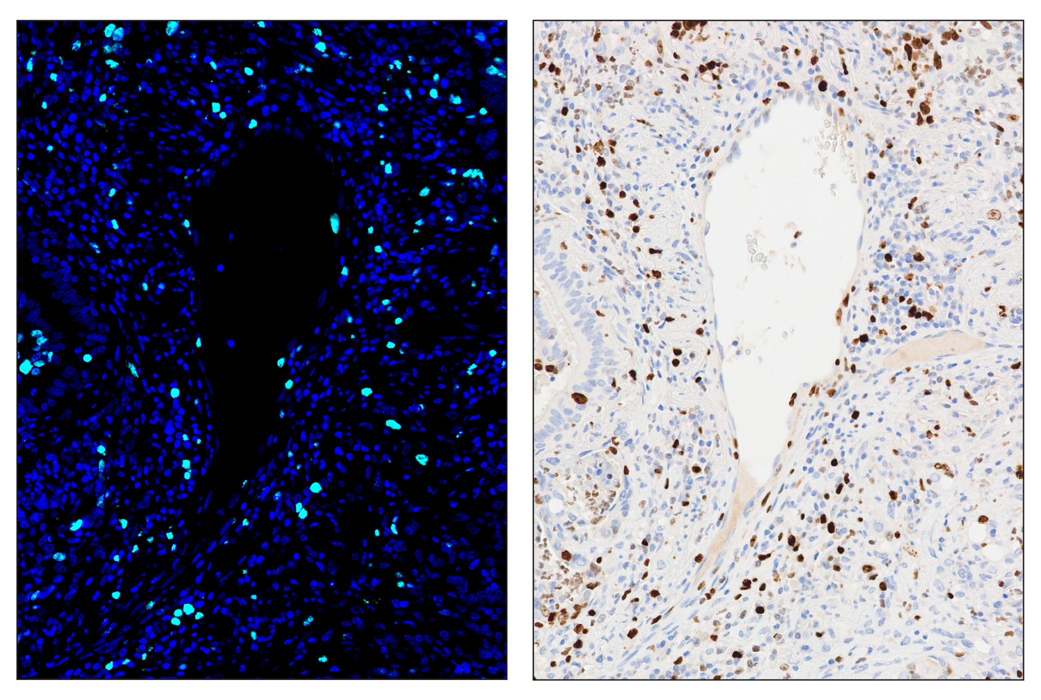 Immunohistochemistry Image 6: Ki-67 (8D5) & CO-0014-488 SignalStar™ Oligo-Antibody Pair