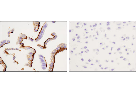 Immunohistochemistry Image 6: CD133 (D2V8Q) XP® Rabbit mAb