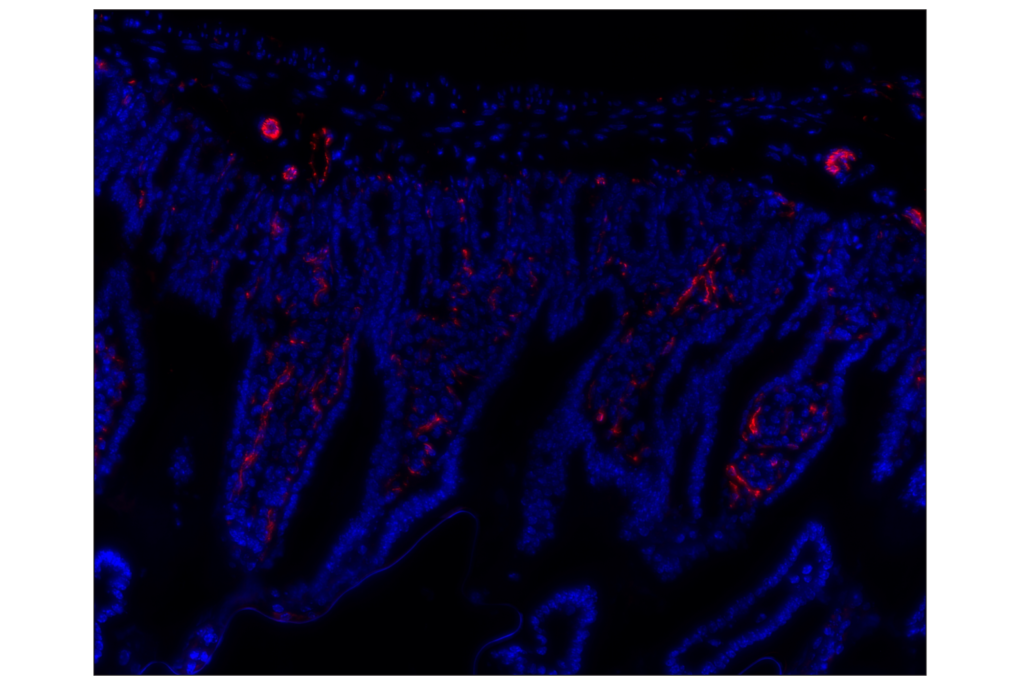 Immunohistochemistry Image 1: CD31 (PECAM-1) (D8V9E) XP® Rabbit mAb (Alexa Fluor® 647 Conjugate)