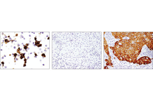 Immunohistochemistry Image 2: EGF Receptor vIII (D6T2Q) XP® Rabbit mAb