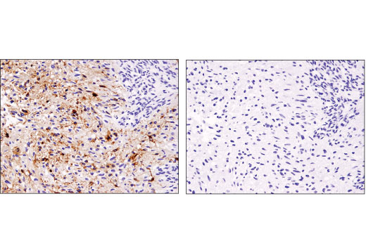 Immunohistochemistry Image 3: EGF Receptor vIII (D6T2Q) XP® Rabbit mAb (BSA and Azide Free)