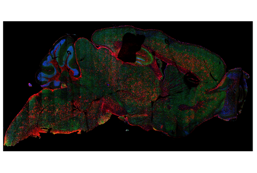 Immunofluorescence Image 1: EEA1 (C45B10) Rabbit mAb (BSA and Azide Free)