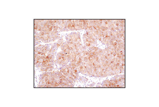 Immunohistochemistry Image 1: Fatty Acid Synthase (C20G5) Rabbit mAb (BSA and Azide Free)