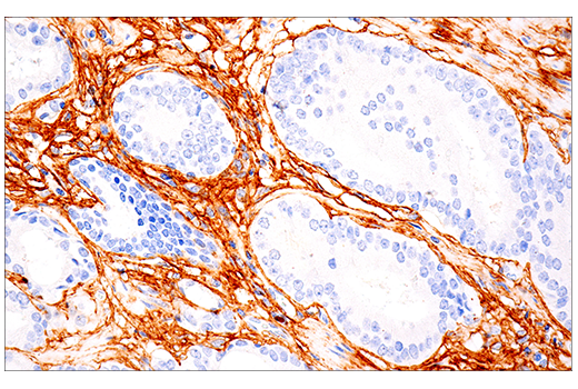 Immunohistochemistry Image 2: COL1A1 (E3E1X) Mouse mAb (BSA and Azide Free)