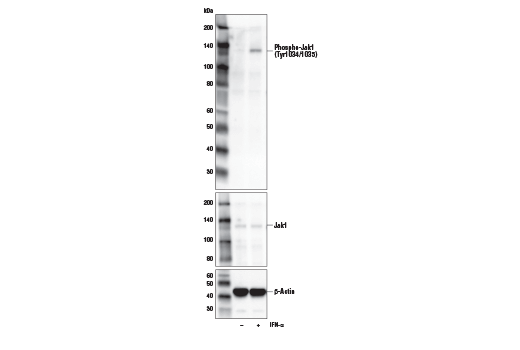 Western Blotting Image 2: Phospho-Jak1 (Tyr1034/1035)/Jak2 (Tyr1007/1008) (E9Y7V) Mouse mAb