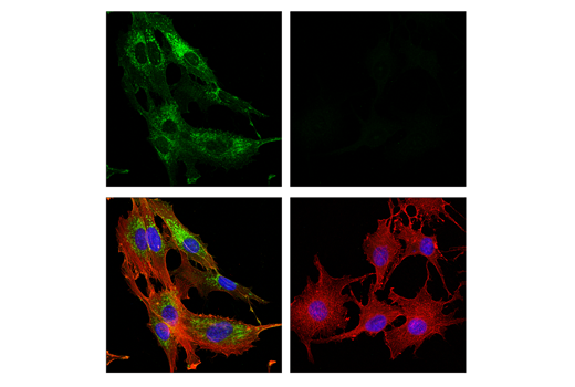  Image 28: Cancer Associated Fibroblast Marker Antibody Sampler Kit