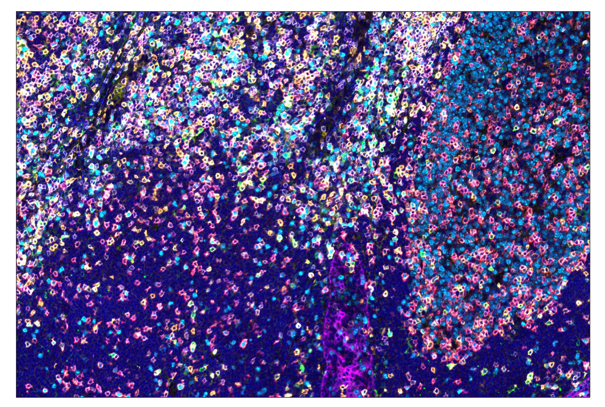 Immunohistochemistry Image 7: Phospho-SLP-76 (Ser376) (E3G9U) & CO-0018-647 SignalStar™ Oligo-Antibody Pair