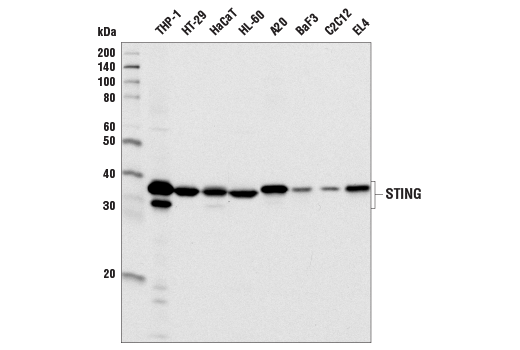 Western Blotting Image 2: STING (D2P2F) Rabbit mAb (BSA and Azide Free)