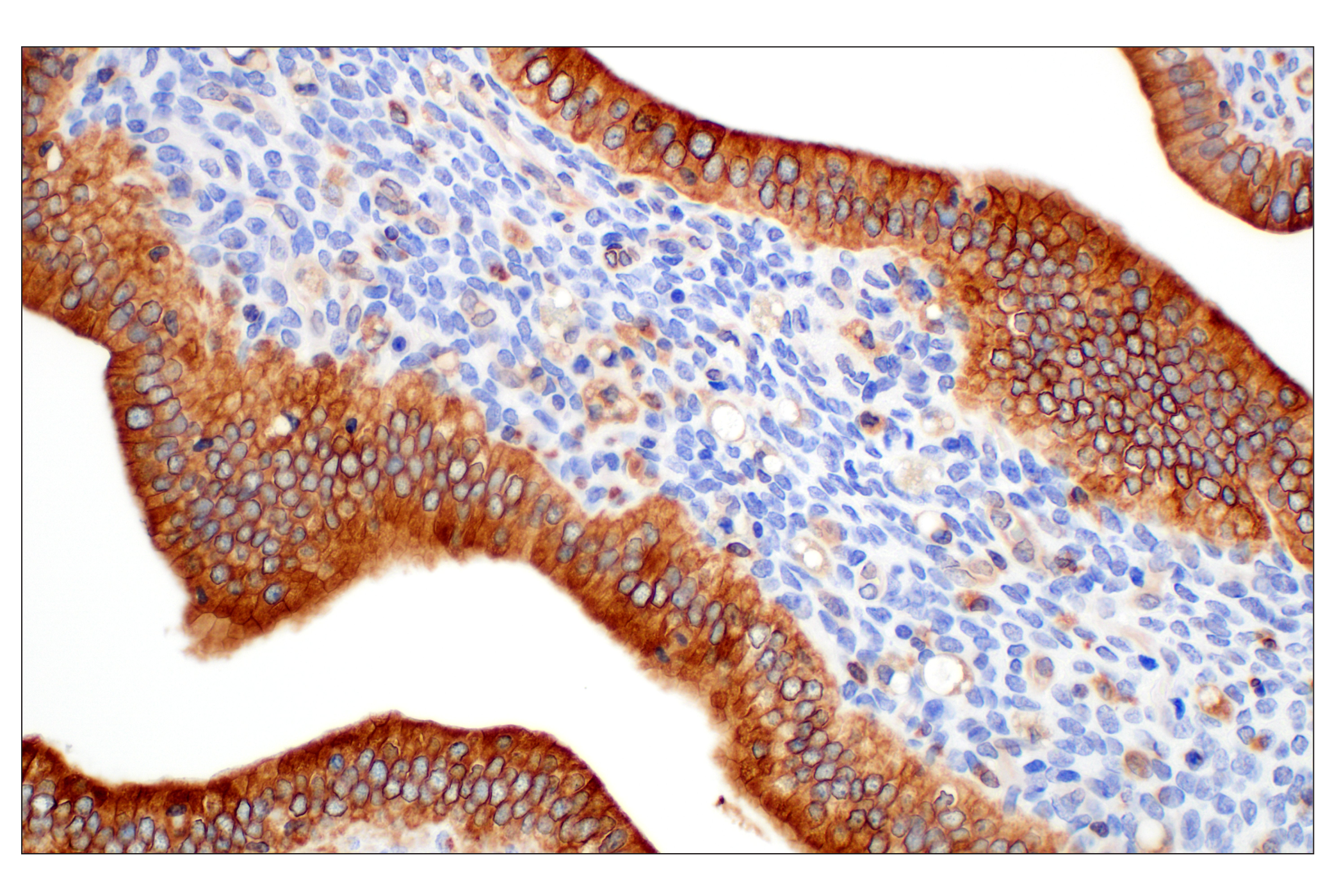 Immunohistochemistry Image 9: STING (D2P2F) Rabbit mAb (BSA and Azide Free)