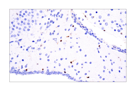  Image 40: Microglia LPS-Related Module Antibody Sampler Kit