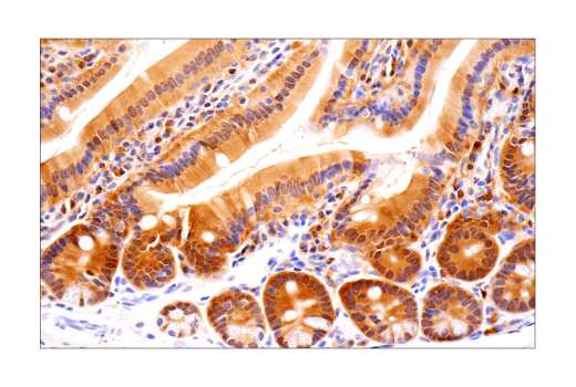 Immunohistochemistry Image 6: ASC/TMS1 (D2W8U) Rabbit mAb (BSA and Azide Free)