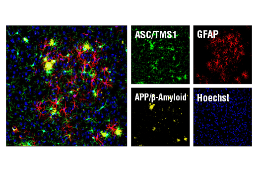 Immunofluorescence Image 1: ASC/TMS1 (D2W8U) Rabbit mAb (BSA and Azide Free)
