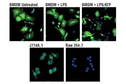 Immunofluorescence Image 2: ASC/TMS1 (D2W8U) Rabbit mAb (BSA and Azide Free)
