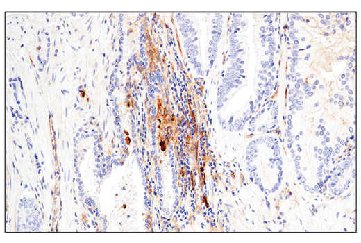 Immunohistochemistry Image 7: CD54/ICAM-1 (E3Q9N) XP® Rabbit mAb