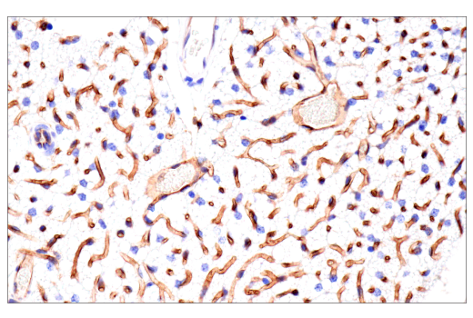 Immunohistochemistry Image 10: CD38 (E9F5A) XP® Rabbit mAb