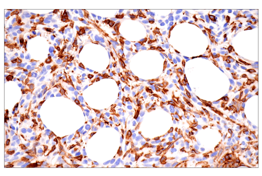 Immunohistochemistry Image 1: CD38 (E9F5A) XP® Rabbit mAb