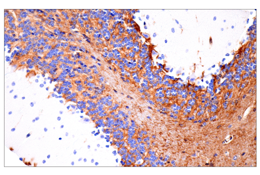 Immunohistochemistry Image 14: CD38 (E9F5A) XP® Rabbit mAb