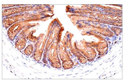 Immunohistochemistry Image 13: CD38 (E9F5A) XP® Rabbit mAb