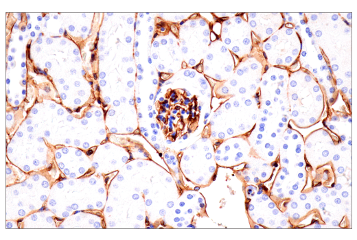 Immunohistochemistry Image 11: CD38 (E9F5A) XP® Rabbit mAb