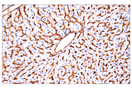 Immunohistochemistry Image 9: CD38 (E9F5A) XP® Rabbit mAb