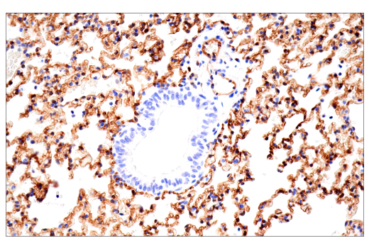 Immunohistochemistry Image 8: CD38 (E9F5A) XP® Rabbit mAb