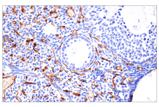 Immunohistochemistry Image 5: CD38 (E9F5A) XP® Rabbit mAb