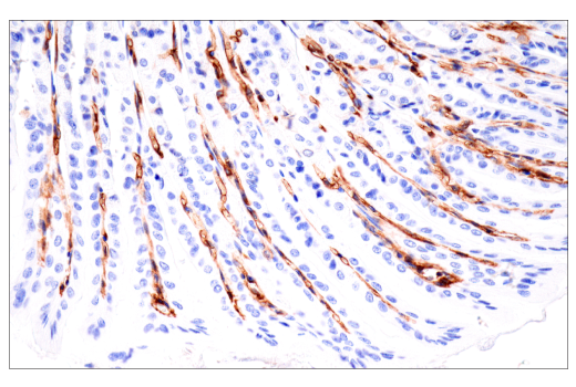 Immunohistochemistry Image 7: CD38 (E9F5A) XP® Rabbit mAb